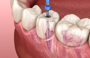 SmileOn.Dentist