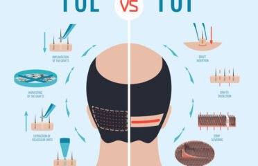 Hair Transplant Clinic