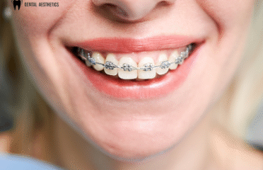 Dental Aesthetics